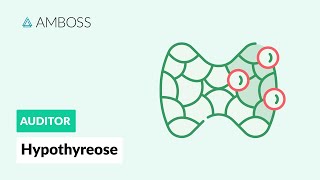 Hypothyreose  Interpretation der Laborwerte  AMBOSS Auditor [upl. by Nayarb]